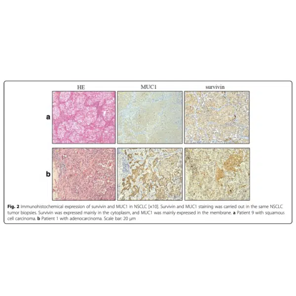 Immunohistochemical expression