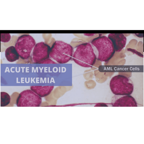 AML Cancer Cells