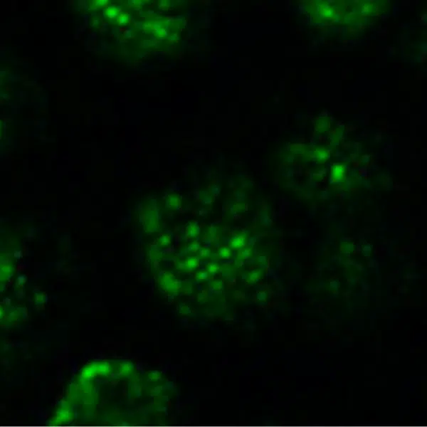 Dendritic Cell Activity