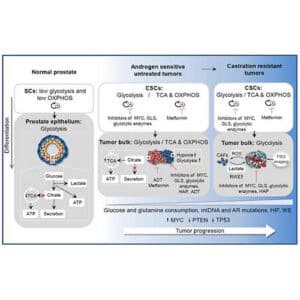 Concise Review: Prostate Cancer Stem Cells: Current Understanding - immucura - treatment