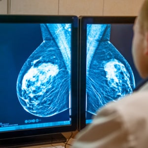 Breast Cancer: Recognizing Symptoms and Risk Factors - immucura - symptoms