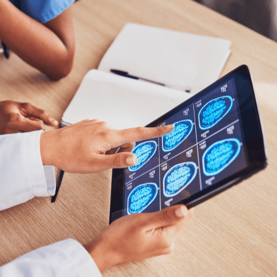 Brain cancer statistics immucura