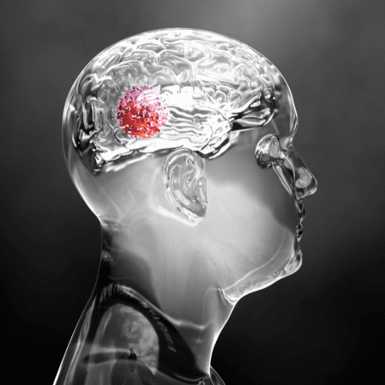 Combining Dendritic Cell Therapy with Nanothermia
