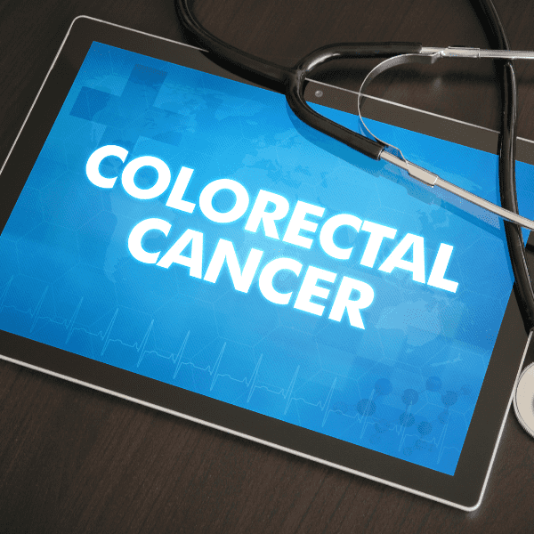 The Efficacy of Dendritic Cell Therapy on Colorectal Cancer at Immucura