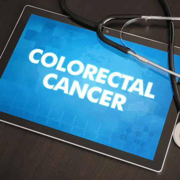 The Efficacy of Dendritic Cell Therapy on Colorectal Cancer at Immucura