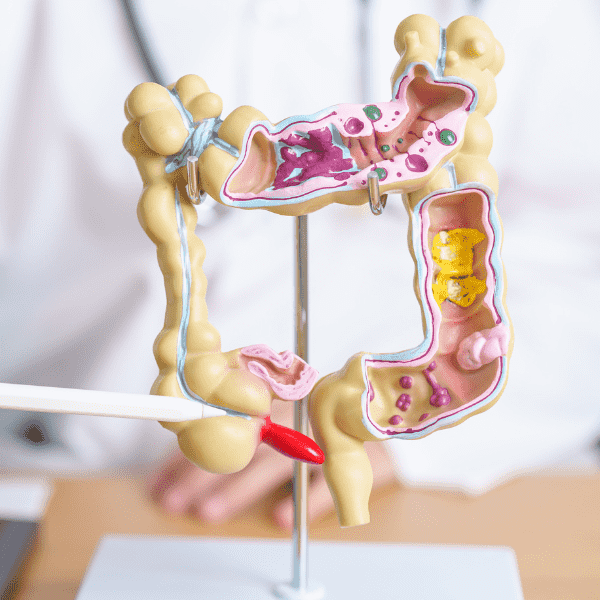 Revolutionizing Colorectal Cancer Therapy: Cutting-Edge Approaches and Breakthroughs