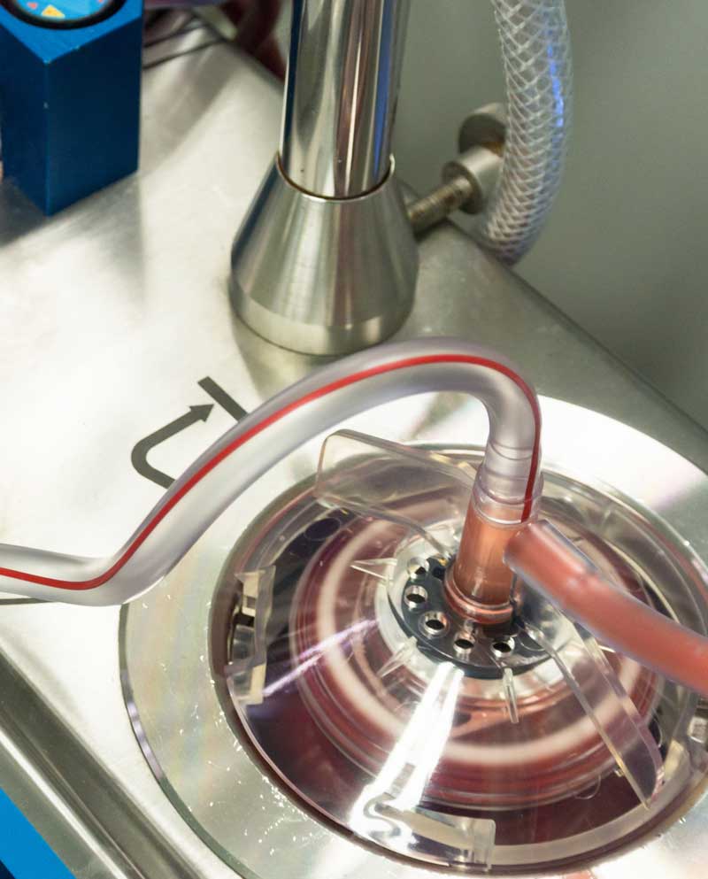 Autologous Priming