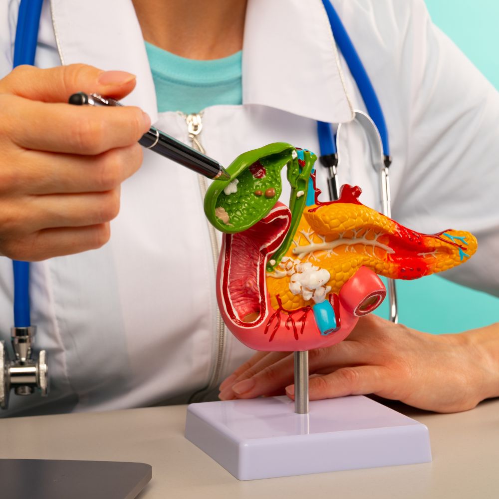 Resected Pancreatic Cancer